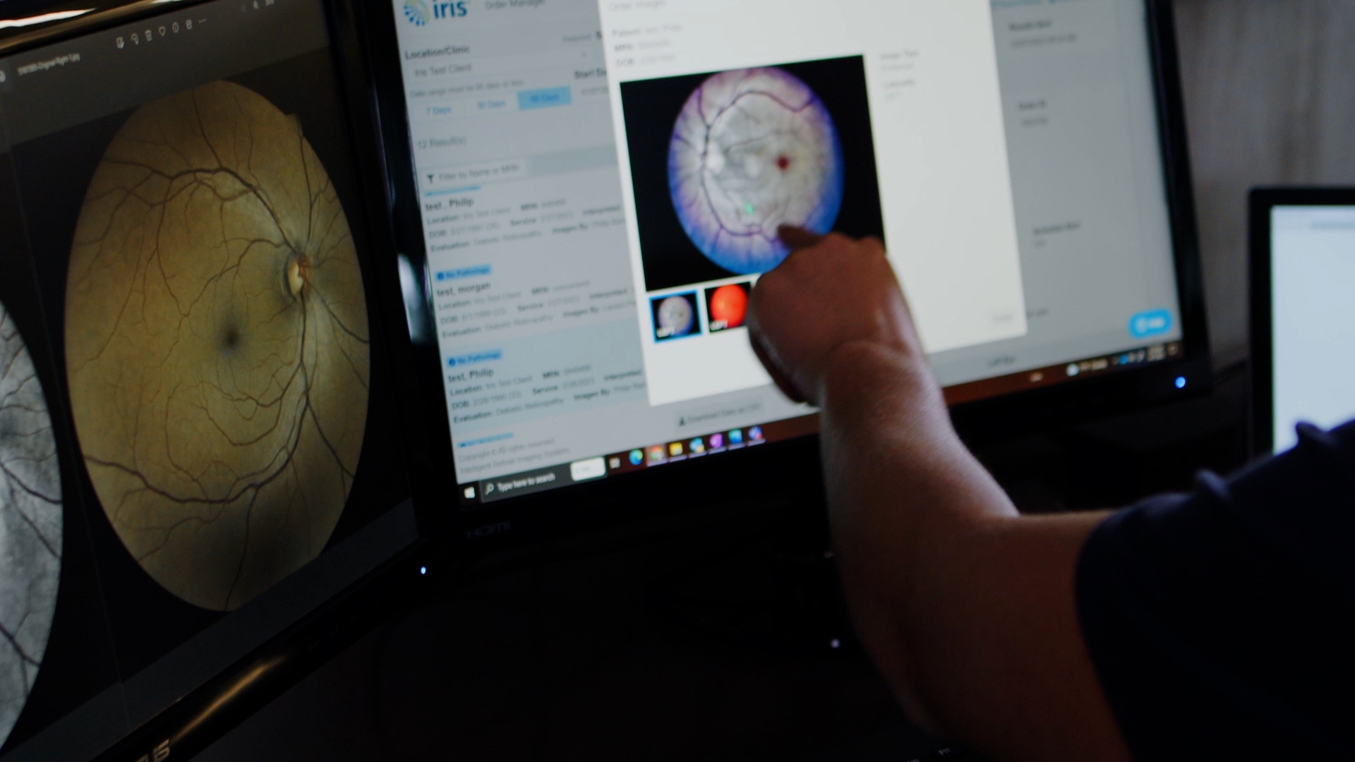 A person points at an image of an eye on a computer screen displaying eye scans and related data.